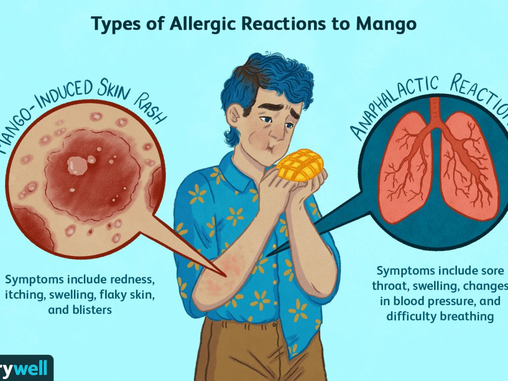 mango allergy cross reactivity